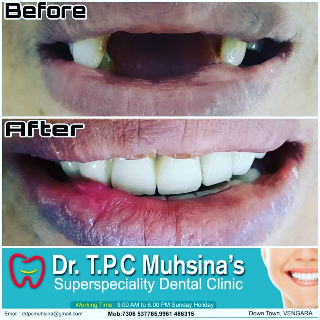 Dr.T.P.C Muhsina's SuperSpeciality Dental Clinic